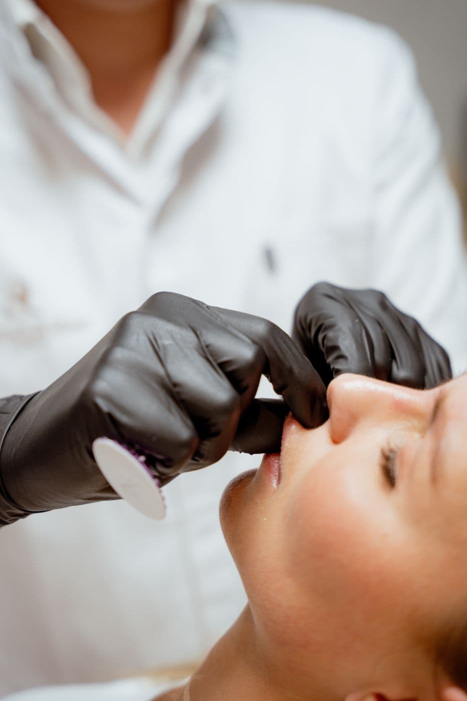 Lipbehandeling bij Medisch & Mooi
